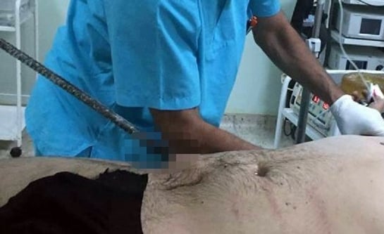 Karnına saplanan bir metre demir çubukla hastaneye getirildi