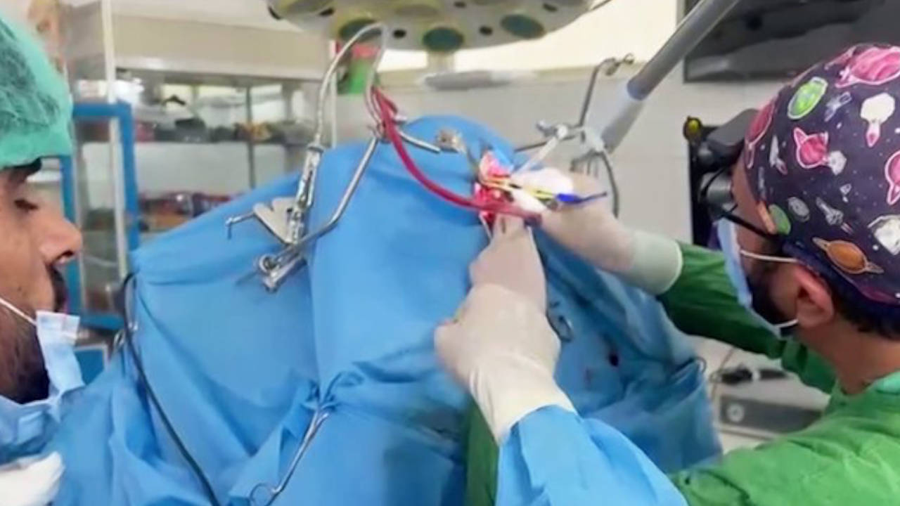 Afganistan İslam Emirliği'nde ilk beyin tümörü ameliyatı başarıyla yapıldı