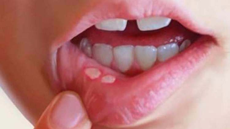 Aft çıkarsa hemen bunu yapın!