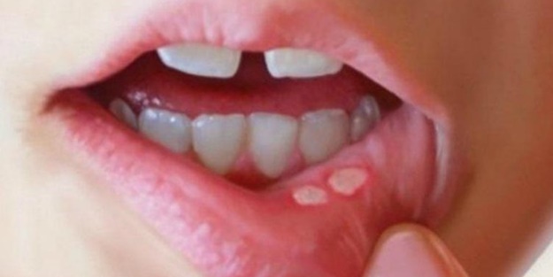 Aft kanser habercisi mi?