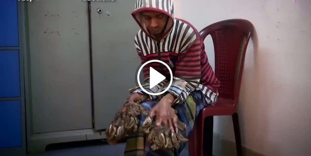 Ağaç adam görenleri şaşırtıyor