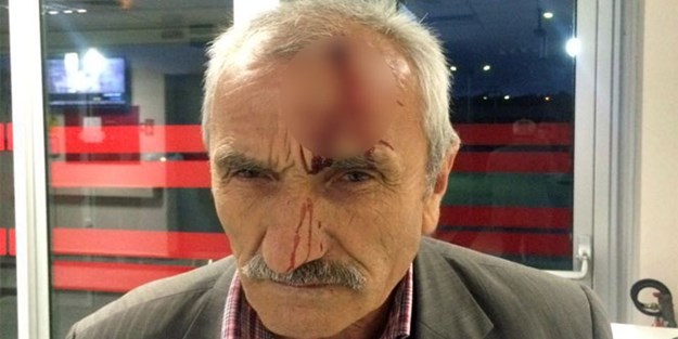 Ağaçtan erik aldı diye amcasını baltayla yaraladı