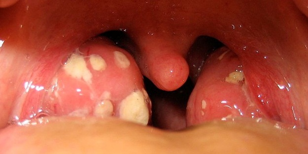 Ağız kokunuzun sebebi bu olabilir!