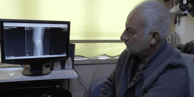 Ağrıları artınca doktora gitti, bacağından mermi çıktı!