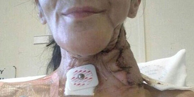 Ağzındaki şişliği yara zannetti ama...