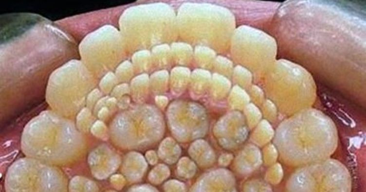 Ağzından tam 232 diş çektiler!