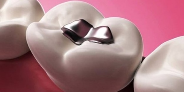 Ağzınızda bunlardan varsa... - FOTO