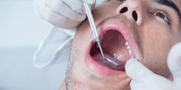 Ağzınızda, dudağınızda ya da dilinizde bu varsa büyük risk altındasınız! Sinsi tehlike: Ağız kanseri