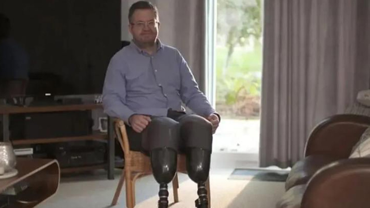 Ahlaksız doktora meslekten men! Sigorta parası için bacaklarını kestirdi