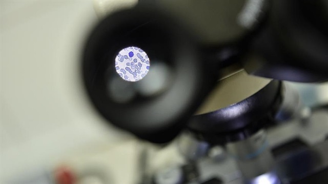 AIDS ile mücadelede yeni yöntem