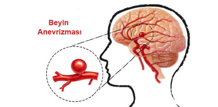 Genetik yatkınlık riski taşıyor!