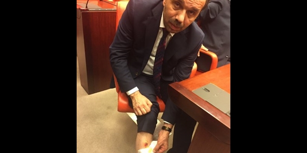 AK Partili vekili bacağından ısıran CHP'li vekil bakın kim