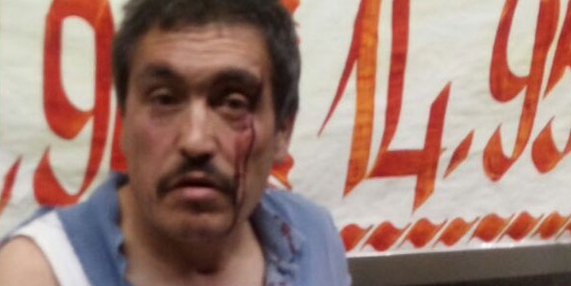 Akciğer kanseri adamı oğluyla birlikte darp ettiler!