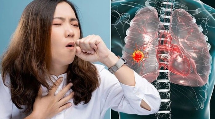 Akciğer kanserinde en sık görülen 12 belirti açıklandı