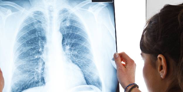 Akciğer kanserinin 6 önemli nedeni