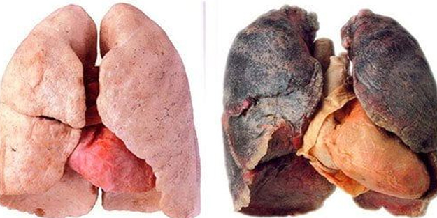 Akciğerdeki katranı ve nikotini arındıran efsane karışım bakın ne oldu: Yetkililer uyardı, tavsiye verdi! Hemen yapın