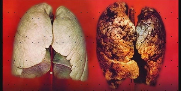 Akciğerlerinizi 3 günde temizleyin