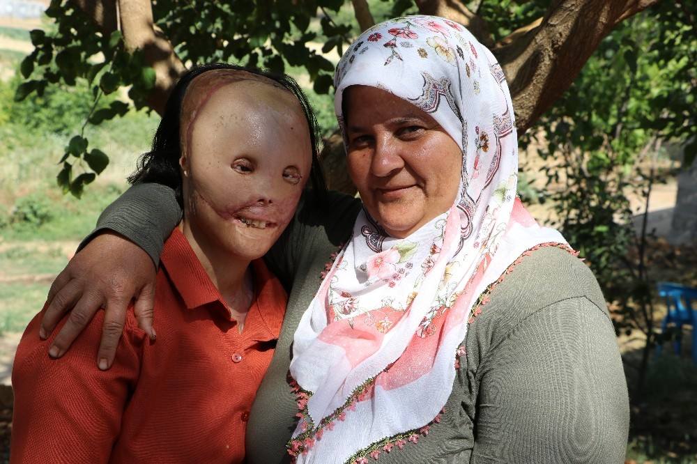 Akdeniz Üniversitesi Layla’nın yüzünü güldürdü 