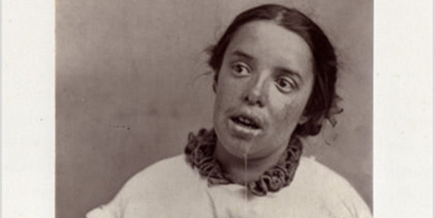 Akıl hastanesinden kan donduran kareler - FOTO