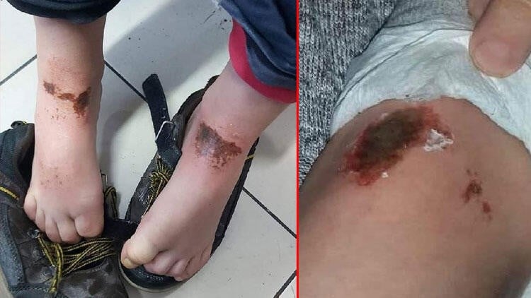 Akılalmaz olay! Kar topu oynayan öğrenciler hayatlarının şokunu yaşadı