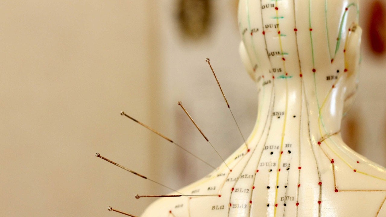 Akupunktur Nedir? Ağrı ve Stresle Mücadelede Etkili mi?
