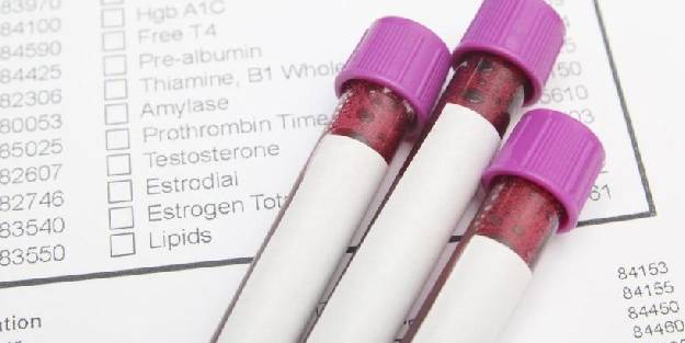 Alanin Aminotransferaz nedir?