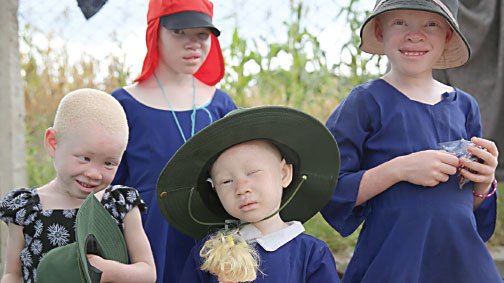 Albinolar katlediliyor