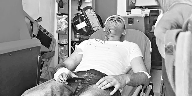 Alçak saldırıda derin izler