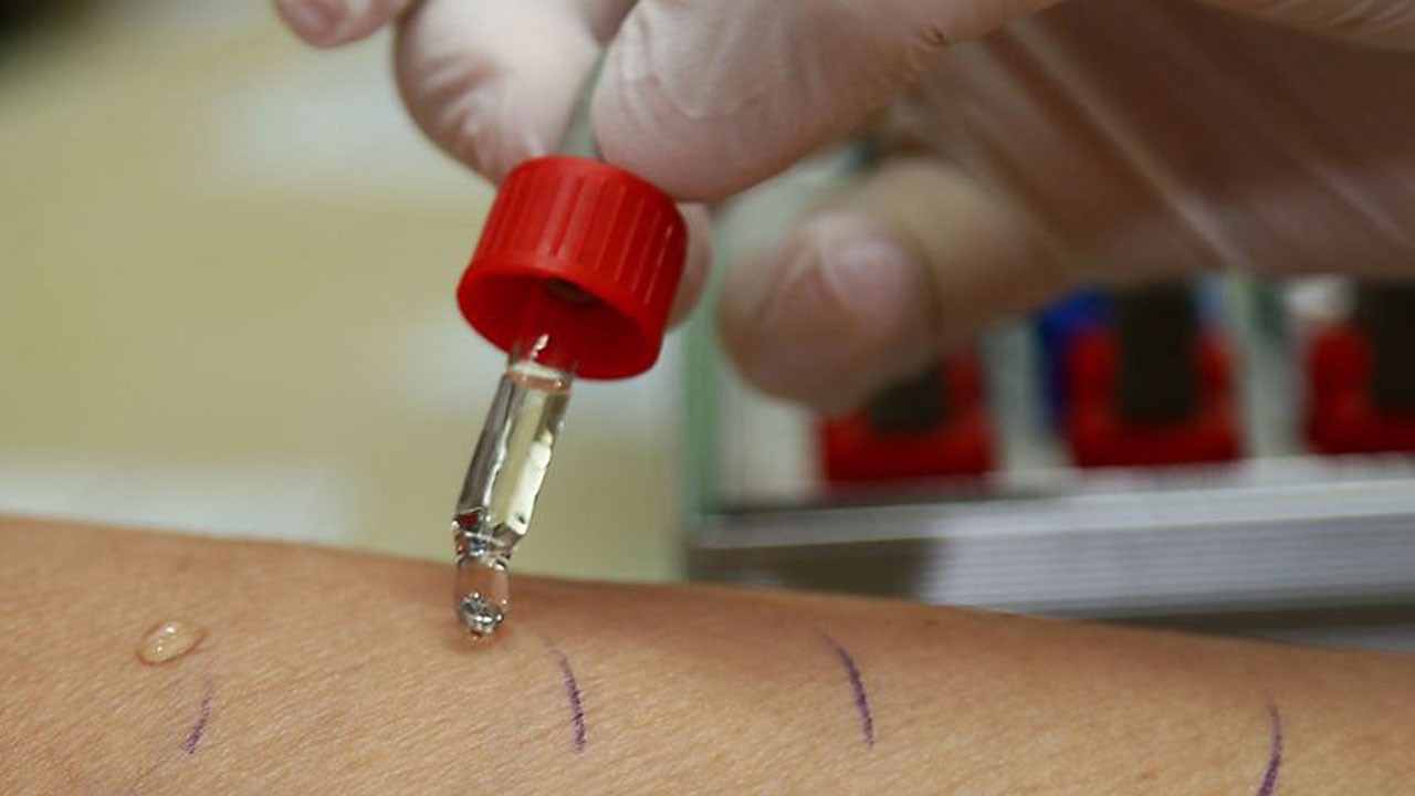 Alerji mi, soğuk algınlığı mı? Belirtiler karıştırılıyor