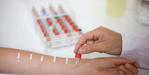 Alerji testi nasıl yapılır?