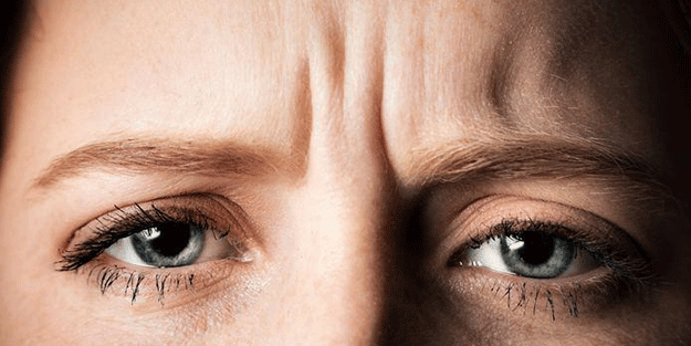 Alında bu işaretler varsa... Hastalık riskini öğrenebilirsiniz