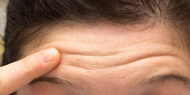 Alındaki bu kırışıklıklar ciddi bir hastalığın habercisi!