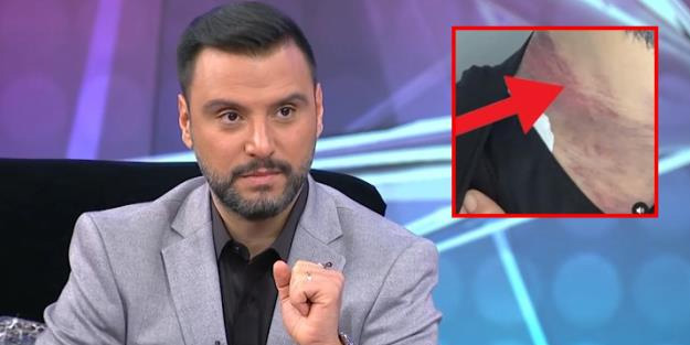 Alişan ölümden döndü! Başına gelenler ağızları açık bıraktı