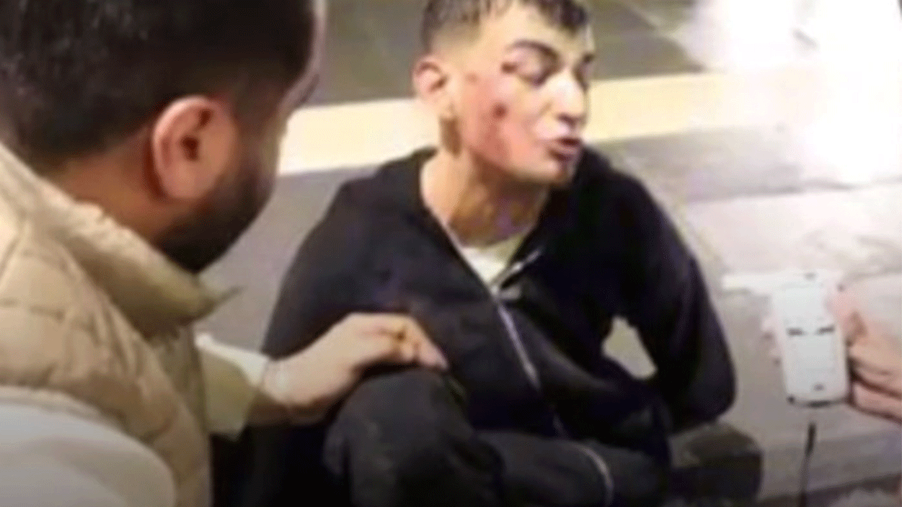 Alkollü kaza yapan sürücünün bahanesi pes dedirtti!