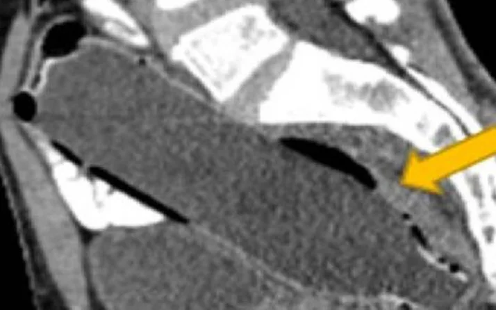 Allah senin belanı versin pis sapık! Yaptığı hareket 