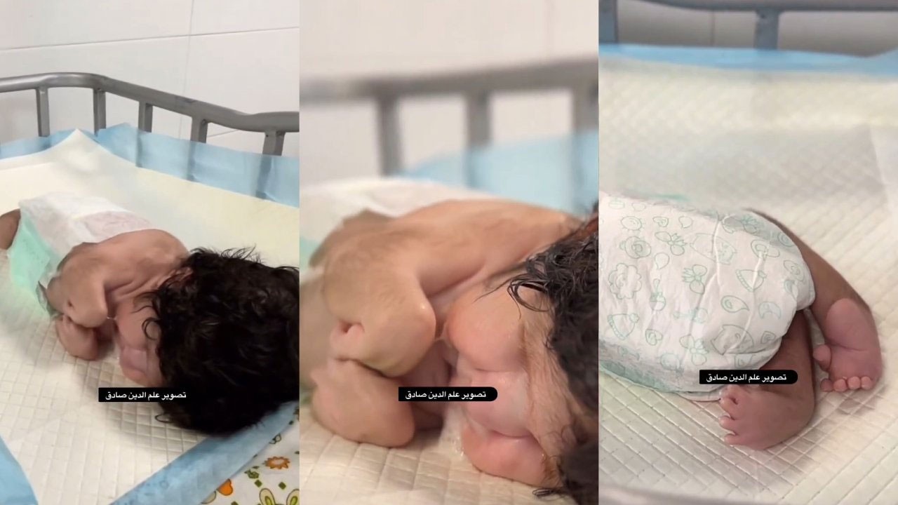 Allah’ın belası İsrail! Siyonist vahşet yüzünden bebekler böyle doğmaya başladı