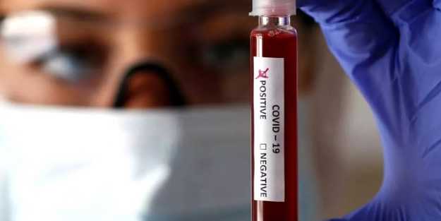 Alman bilim adamlarından koronavirüs araştırması: Kan gurubu A olanlar...