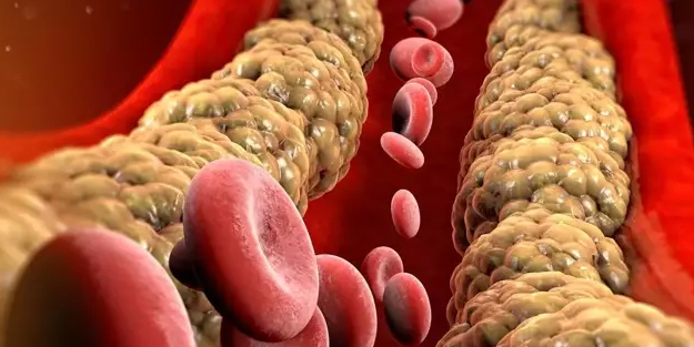 Almanların yıllardır uyguladığı tarif! Damarlardaki yağı ve kolesterolü söküp atıyor!