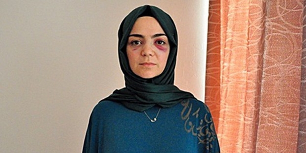 Almanya'da Türk hanımı yumruklayan kişi bakın kim çıktı