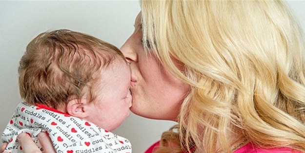 Alnını gören hayret ediyor! - FOTO