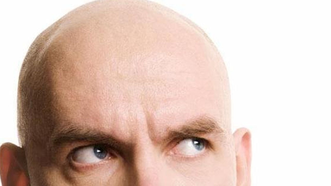 Aloe vera: Şampuan kel bırakıyor diyenler hayran kalıyor! Herkes çok beğendi! Siz yapın