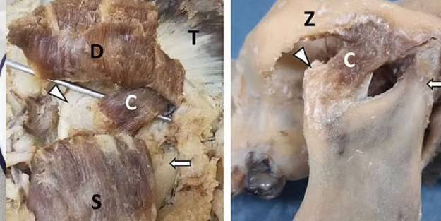 Alt çenede yeni bir kas tabakası keşfedildi