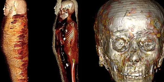 Altın Çocuk'tan çıktı, gizemli mumya bulundu! Binlerce yıllık şaşırtan gerçek tomografiyle çözüldü! Açıklaması...