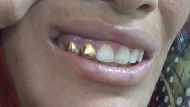 Altın dişli, son model telefonlu dilenciler