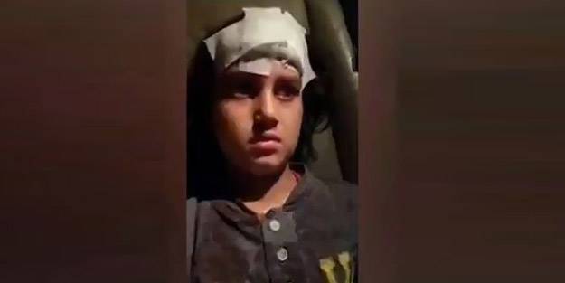 Altındağ'daki provokasyonda yüzü kanlar içinde kalan Suriyeli kız çocuğu: Beni öldürmeyin!