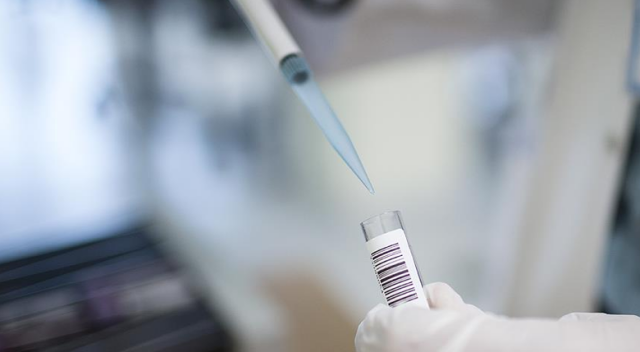 Alzaymırı önleyebilecek yeni bir reseptör hücre bulundu