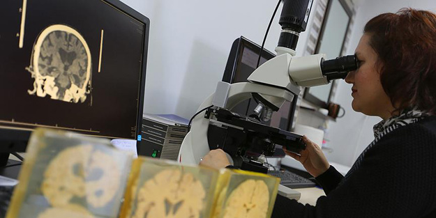 Alzaymırın gizemi böyle çözülecek!