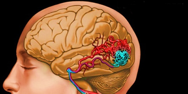 Alzheimer Farkındalık Günü'nde demansı deneyimlediler