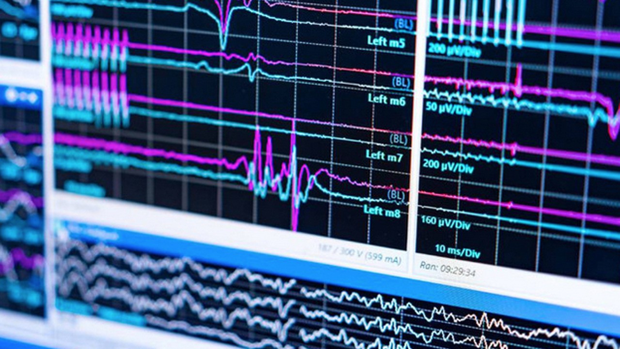 Alzheimer için lityum takviyesi umudu! Çığır açan, umut verici araştırma