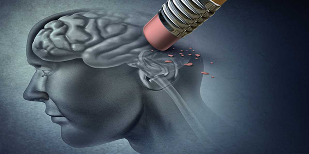 Alzheimer'da umutlandıran gelişme